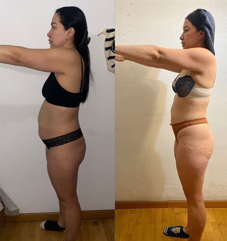 Transformación real de una clienta de HyperClub — antes y después